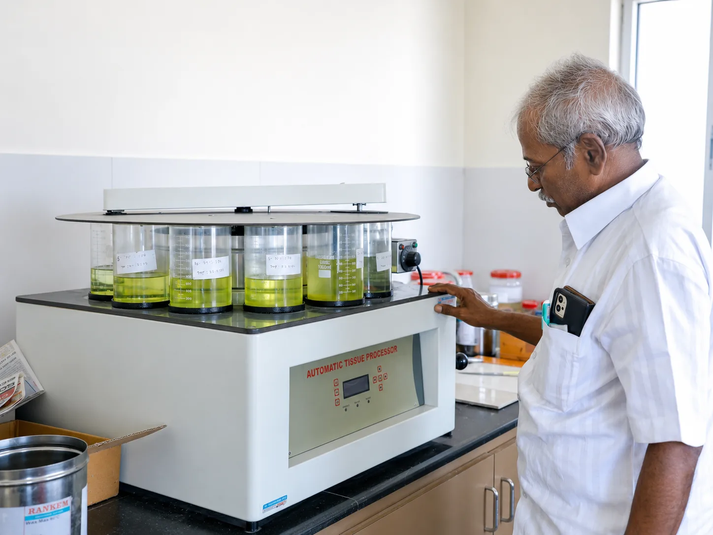 Automatic tissue processor in the SBMCH histopathology laboratory